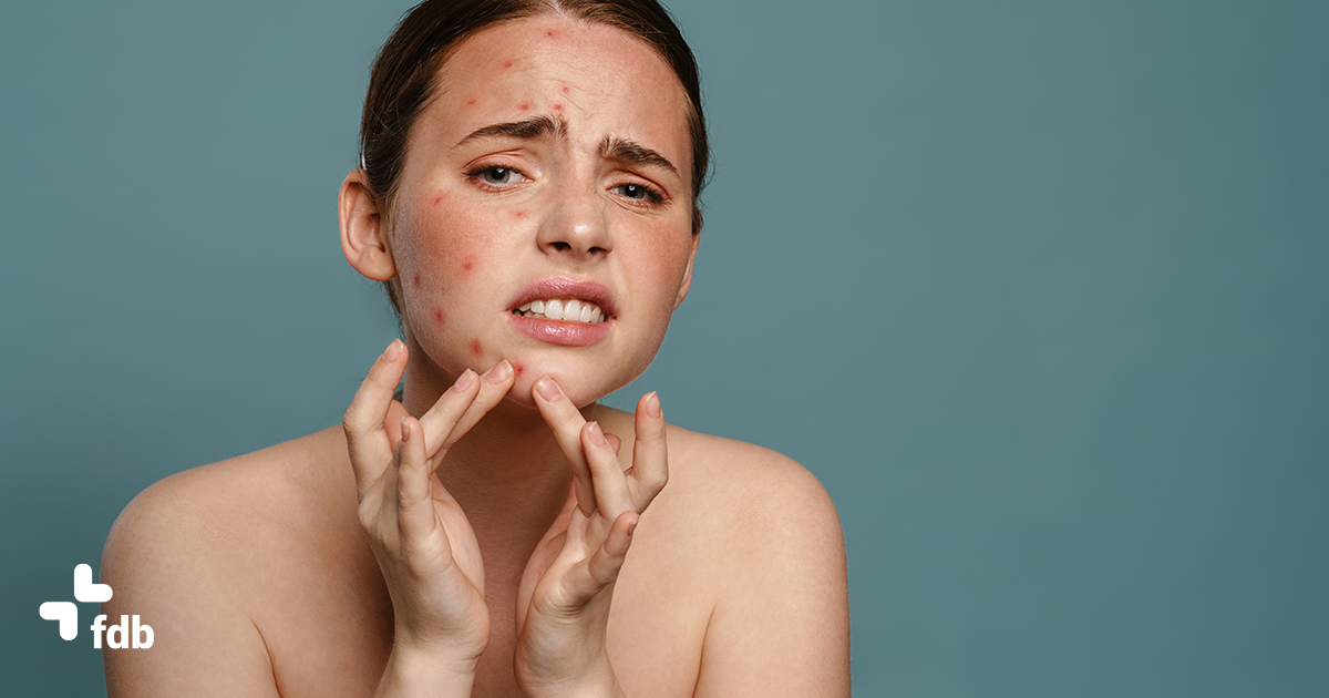 Problemi di brufoli? Ecco le cause e i rimedi