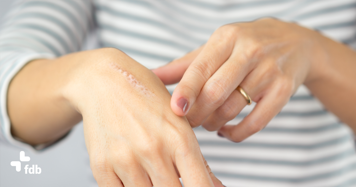 Creme per cicatrici: guida all’acquisto