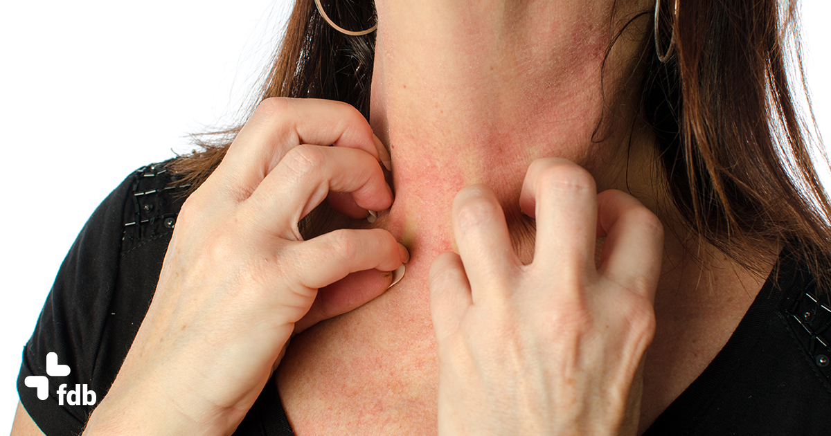 Dermatite da sudore: sintomi e rimedi efficaci