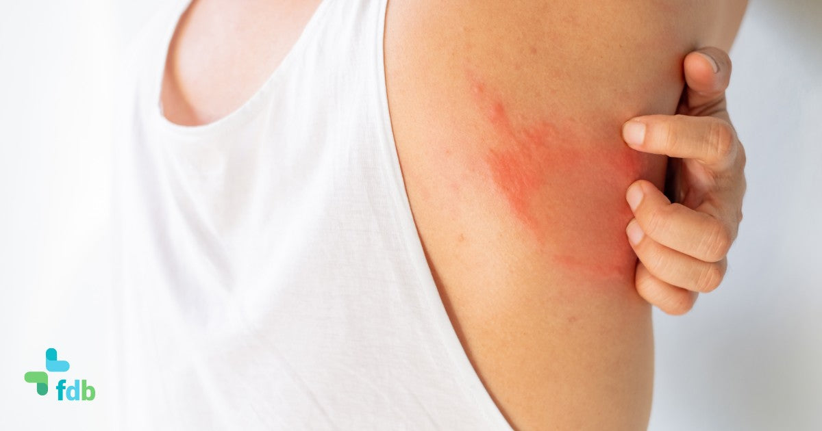 Cause e rimedi per i funghi della pelle