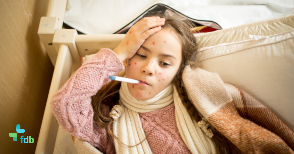 Guida alle malattie esantematiche nei bambini: quali sono e come distinguerle