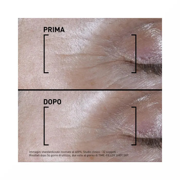 Filorga Time Filler Shot 5xp Siero Concentrato Linee Di Espressione 15ml