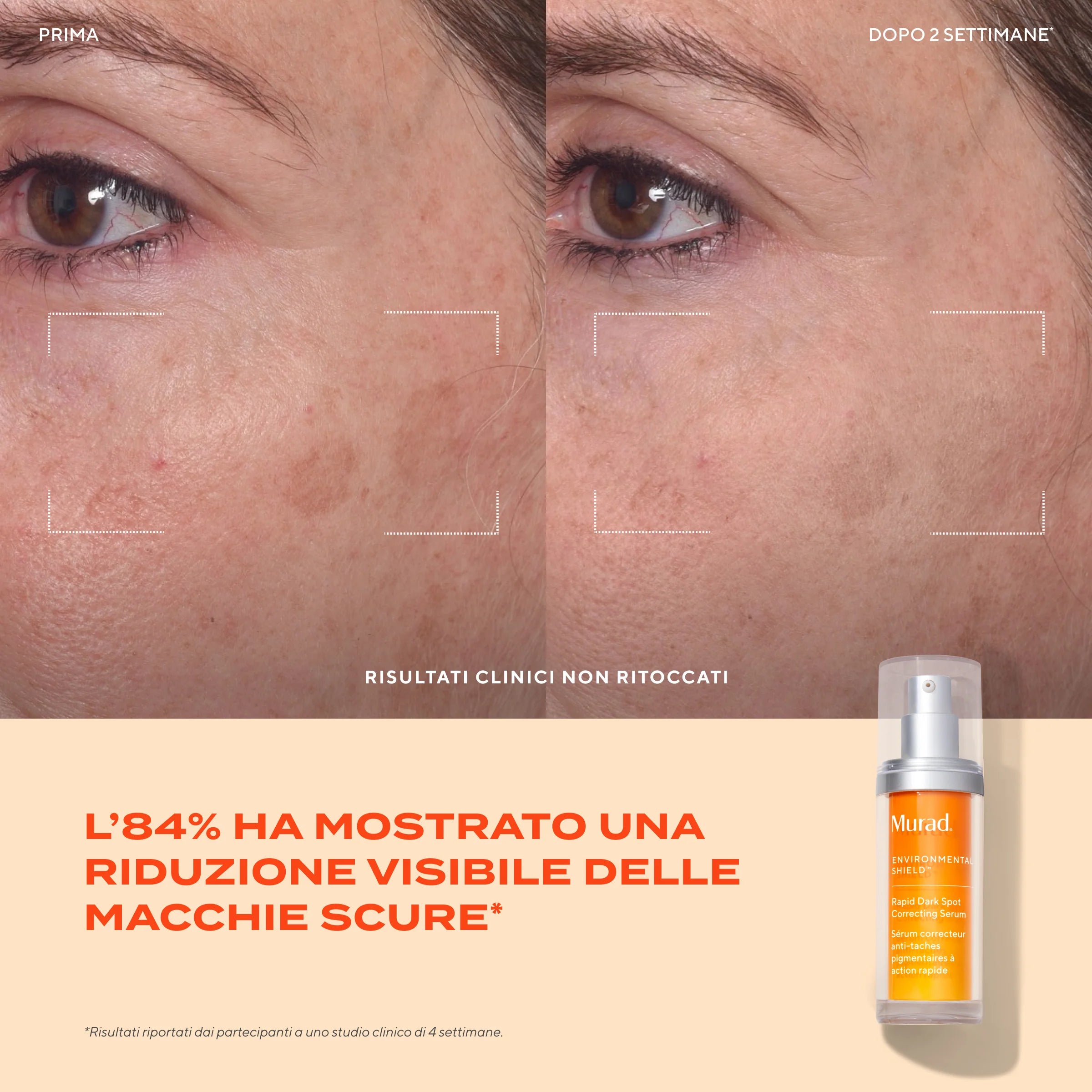 Murad Rapid Dark Spot Correcting Serum 30 Ml