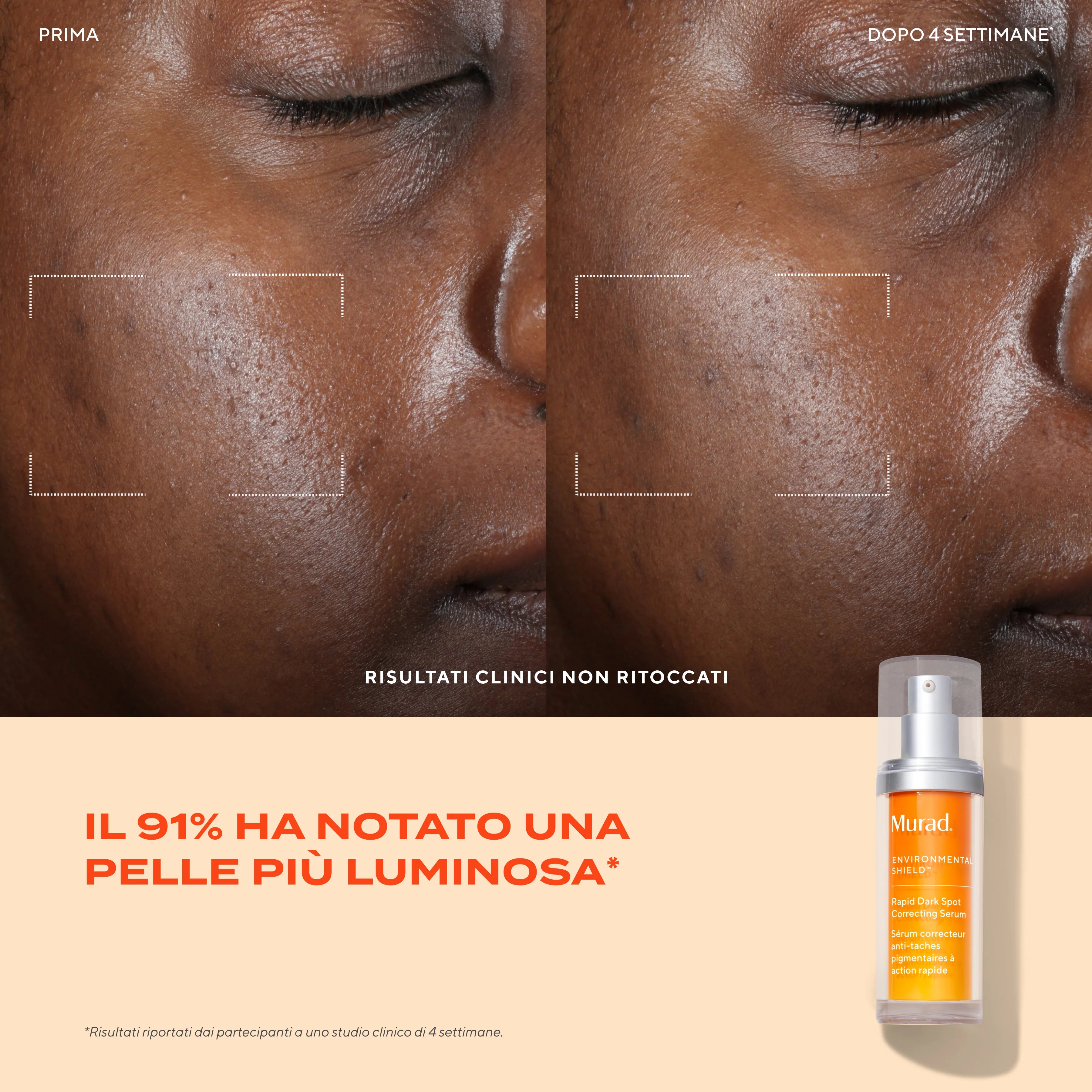 Murad Rapid Dark Spot Correcting Serum 30 Ml