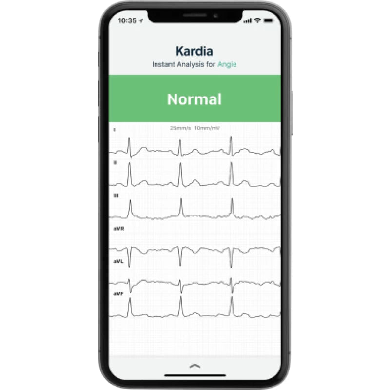 Omron Elettrocardiogramma KardiaMobile 6L KM-6L-E