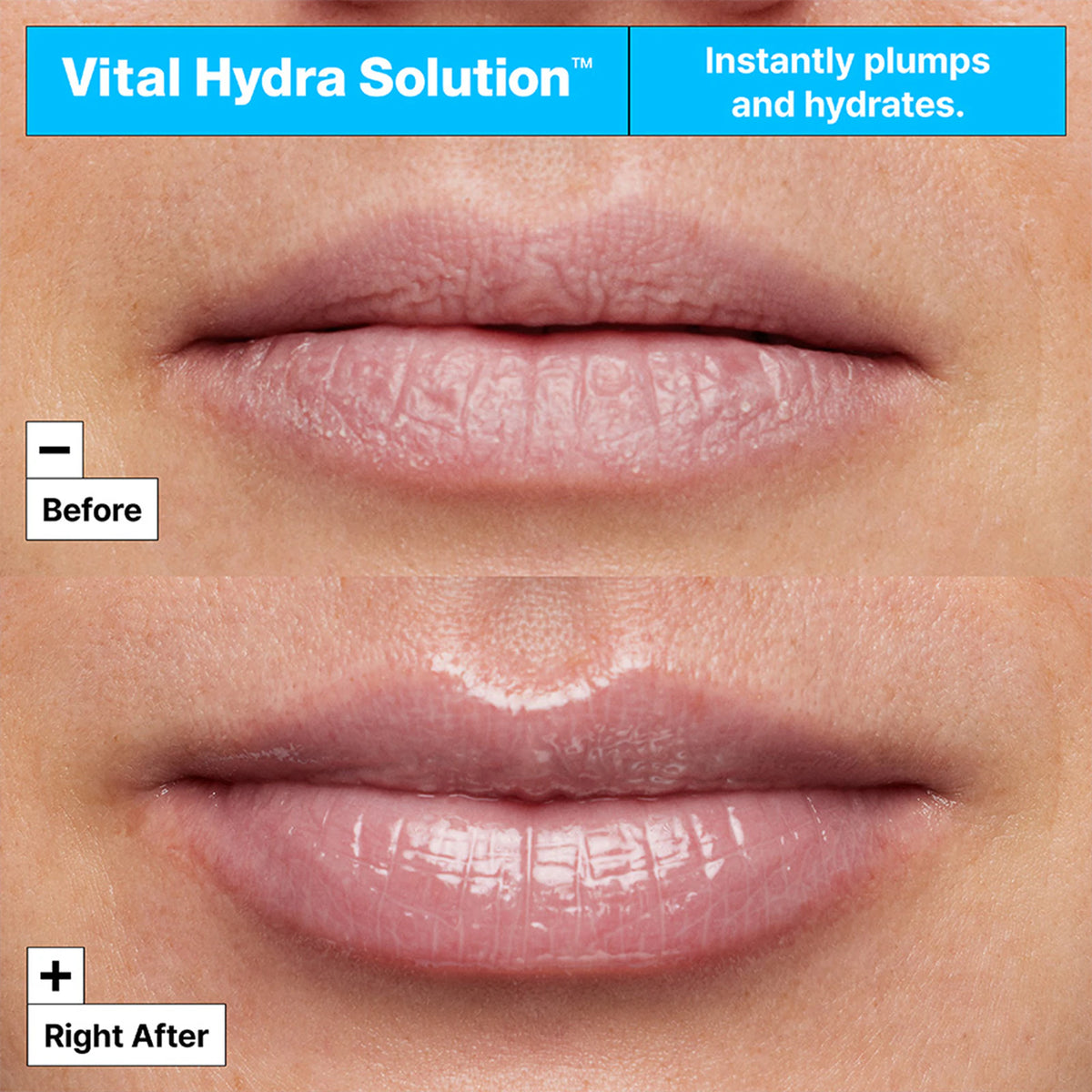 Dr. Jart+ Vital Hydra Solution Hydrating Lip Mask 20 ml