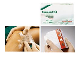 MEDICAZIONE STERILE IN FILM IN POLIURETANO TRASP. SUPRASORBF 10X12CM 10 PEZZI